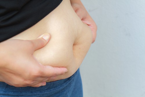 Loạn dưỡng mỡ - Hình ảnh minh họa